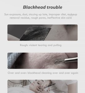 Weja Facial Cleaning 5 Tips Blackhead Remover Electric Vacuum Suction Blackhead Acne Extractor Pores Deeply Cleaning Tool Multifunctional Skin Care Beauty Device MR278W-B 6