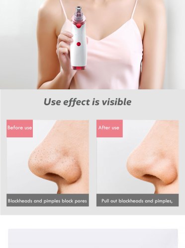 Weja Facial Cleaning 5 Tips Blackhead Remover Electric Vacuum Suction Blackhead Acne Extractor Pores Deeply Cleaning Tool Multifunctional Skin Care Beauty Device MR278W-B